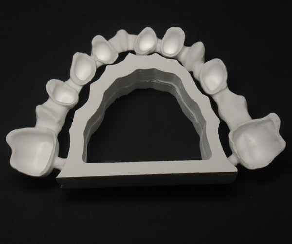 diapo2-prothese-dentaire-600x500