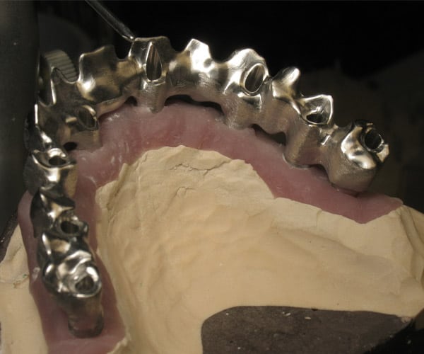 diapo9-prothese-dentaire-600x500